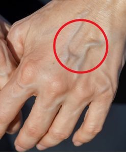 If you have visible veins it means you are… FULL ARTICLE👇 See less